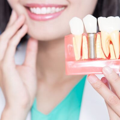 Implant zęba czy boli
