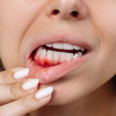 Periodontologia Poznań